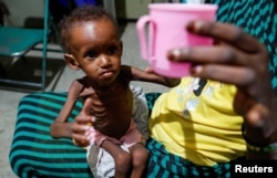 Saddam Najwa, anak berusia 17 bulan yang kekurangan gizi, meraih secangkir air di bangsal anak-anak Rumah Sakit Mother of Mercy di Gidel, dekat Kauda, di Pegunungan Nuba, Kordofan Selatan, Sudan, 25 Juni 2024. (Thomas Mukoya/. REUTERS)