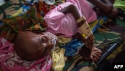 FILE - A Papuan child suffering from malnutrition lies in a hospital bed for treatment in Agats, the capital of Asmat district in Indonesia's easternmost Papua province, Jan. 26, 2018.