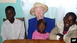 Mary Owido sits with her children Steven, left, Stella, and Brayan. She is albino, lacking pigmentation responsible for giving color to skin, eyes and hair. Mary says she is only comfortable when at work or at home with her husband and children, (File Nov