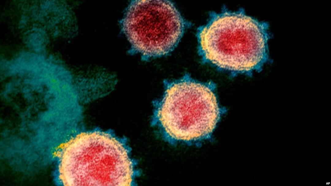 Gambar virus corona yang menyebabkan Covid-19 tampak di mikroskop, Februari 2020. (Foto: Institut Kesehatan Nasional AS via AP)
