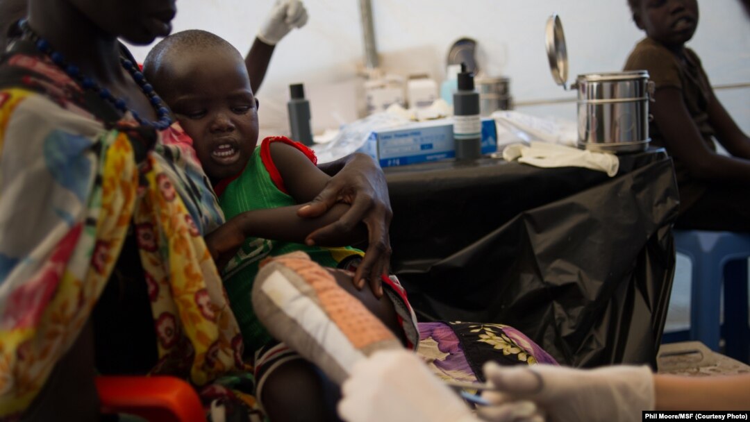 Seorang anak yang kakinya cedera mendapat perawatan dari staf Médecins Sans Frontières (MSF) di sebuah tenda yang dibangun oleh organisasi tersebut di Juba, Sudan Selatan (12/1/2014). 