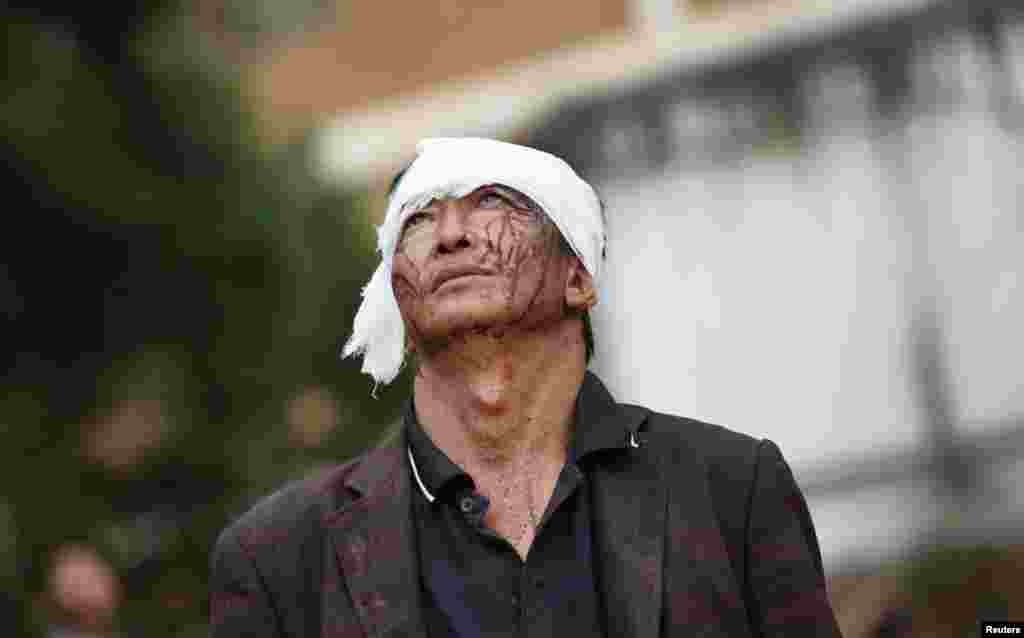 An injured man looks up as he walks past debris after an earthquake hit Ludian county, Yunnan province, China. A magnitude 6.5 earthquake struck southwestern China on Aug. 3, 2014, killing at least 398 people in a remote area of Yunnan province, and causing thousands of buildings, including a school, to collapse, Xinhua News Agency reported.