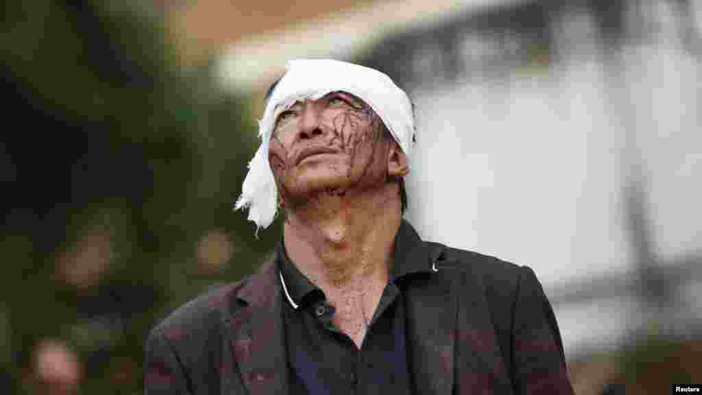 Un homme blessé marche, regard perdu, à côté de débris après un tremblement de terre qui a frappé le comté Ludien, la province du Yunnan, 4 Août 2014.