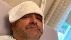 Carlos Gavidia me kompresa të ftohta në ballë (Marrë nga Carlos Gavidia)