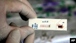 FILE - An HIV/AIDS rapid blood test shows the two red strips of a positive result in an improvised mini-lab, Kyiv, Ukraine.
