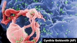 This undated photo provided by the Centers for Disease Control and Prevention shows a scanning electron micrograph of multiple round bumps of the HIV-1 virus on a cell surface. (Cynthia Goldsmith/Centers for Disease Control and Prevention via AP)