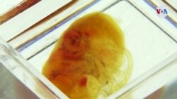 SALUD: Órganos transparentes para trasplantes