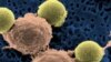 'Serial Killer' Cells Demolish Leukemia Tumors