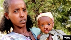 Ethiopia-Baby-Lips split