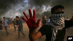 A protester shows his bloody hand while helping a wounded youth as others burn tires near the fence of the Gaza Strip border with Israel east of Khan Younis, southern Gaza Strip, Oct. 19, 2018.