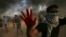 A protester shows his bloody hand while helping a wounded youth as others burn tires near the fence of the Gaza Strip border with Israel east of Khan Younis, southern Gaza Strip, Oct. 19, 2018.