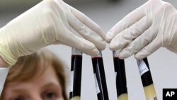 Seorang ilmuwan melakukan penelitian HIV di sebuah laboratorium (foto: ilustrasi).