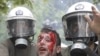 Rough Road Ahead for Greece Despite Austerity Measures