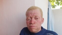 angola namibe albino