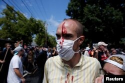 A man is seen with an injury during a clash between members of white nationalist protesters and counterprotesters in Charlottesville, Va., Aug. 12, 2017.