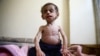 Deliberate Starvation of Civilians in Syria Could Be War Crime
