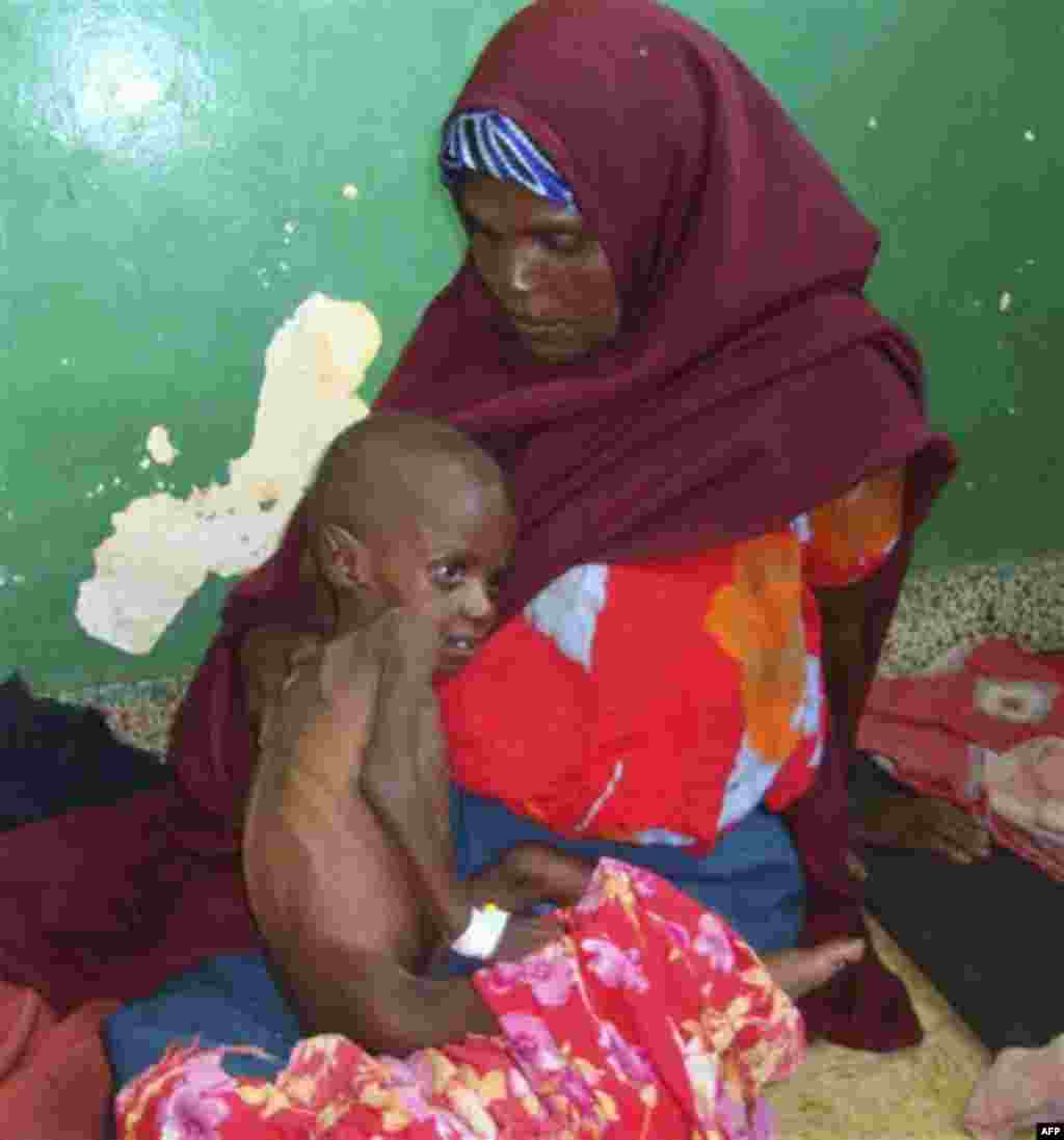 A Somali woman from southern Somalia hold her malnourished child in Banadir hospital in Mogadishu, Somalia, Thursday, July 21, 2011. Somalia's 20-year-old civil war is partly to blame for turning the drought in the Horn of Africa into a famine. Analysts w