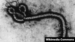 El virus del ébola visto al microscopio.
