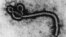 El virus del ébola visto al microscopio.