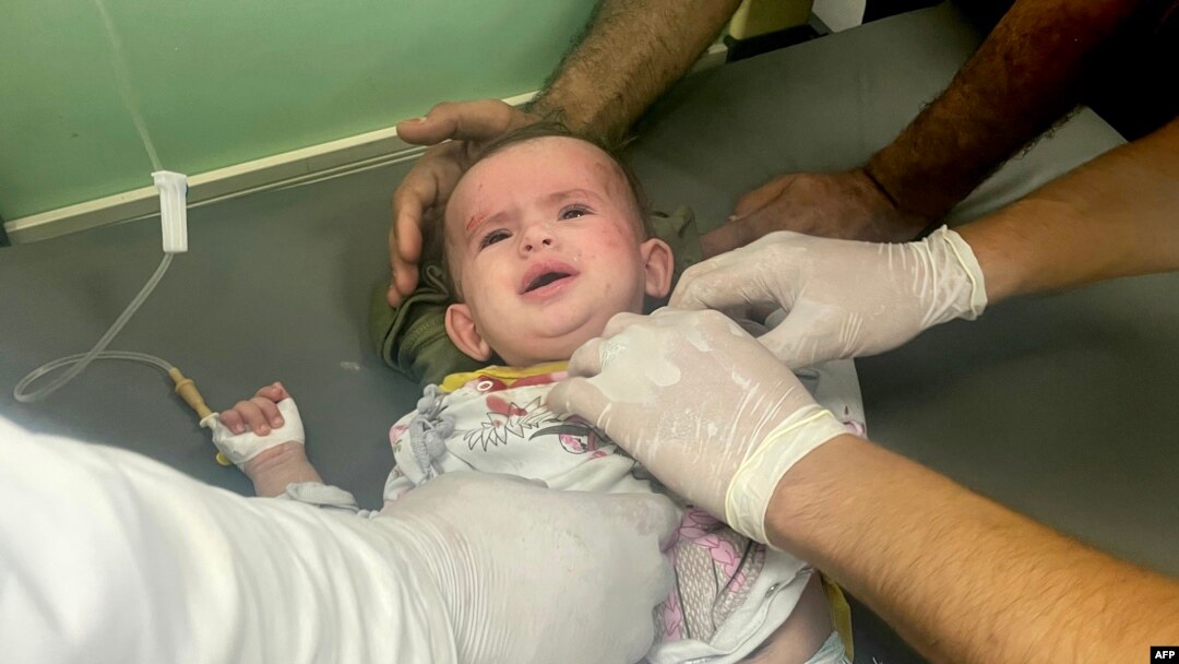 Hirurzi traumatologije zbrinjavaju novorođenče povrijeđeno u izraelskom bombardiranju, u kuvajtskoj bolnici u Rafahu u južnom pojasu Gaze 21. oktobra 2023. 