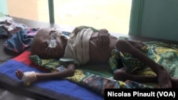 Cet enfant de deux ans présente une forme aiguë de malnutrition. Il ne pèse que 5,6 kilos, Diffa, Niger, le 18 avril 2017 (VOA/Nicolas Pinault)