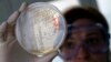 WHO Keluarkan Daftar 12 Bakteri Paling Berbahaya