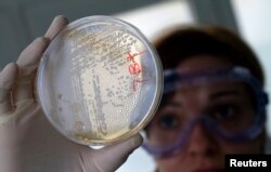 FILE - A laboratory worker looks for strains of E.coli bacteria in vegetable cells placed in a petri dish.