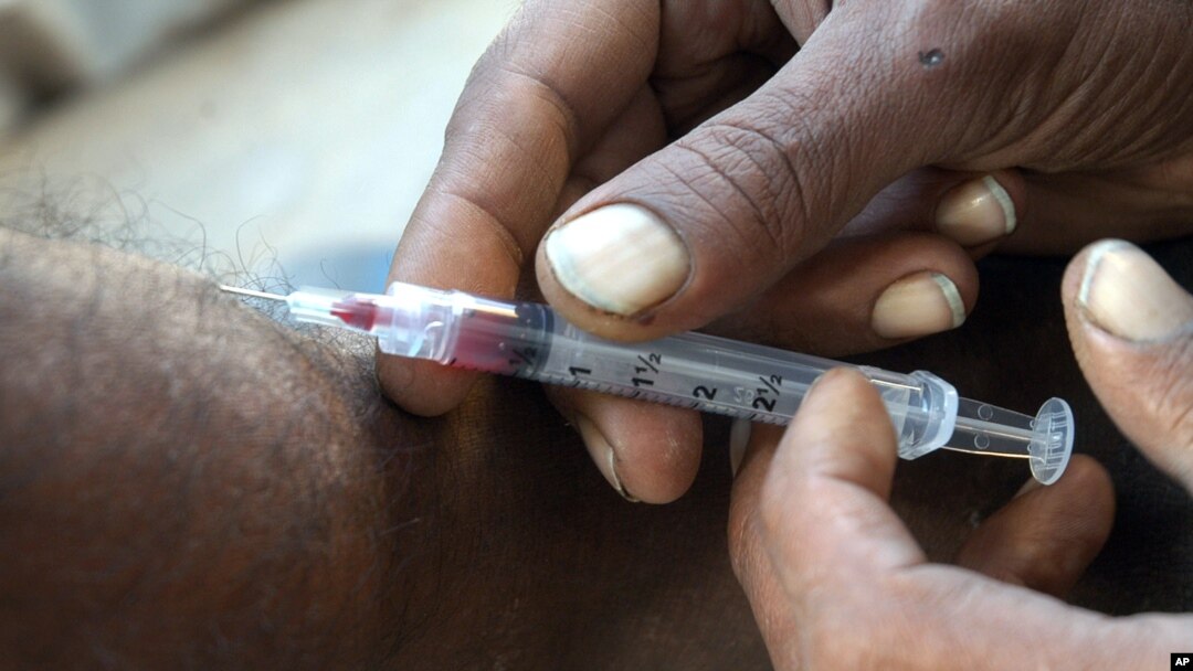HIV