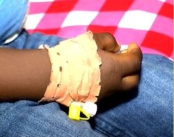 A hand of a child is being treated after swelling up following vaccination, in Ebolowa, Cameroon, Dec. 9, 2019. (Moki Edwin Kindzeka/VOA)
