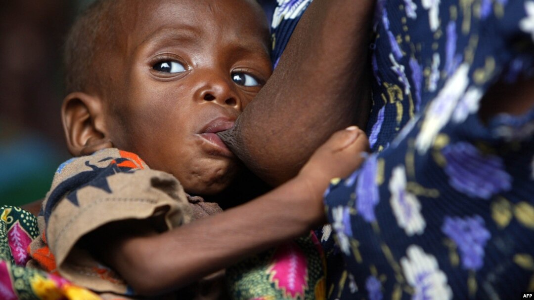 A Malawian child, suffering from HIV, breast-feeds at the Zomba NRU (Nutritional and Rehabilitation Unit), 60 kms south of Blantyre, October 14, 2005 file photo. 