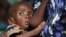 FILE - A Malawian child, suffering from HIV.