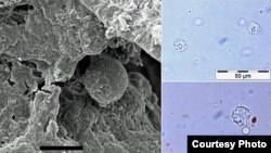 Microscopic fossils of 6,000-year-old garlic mustard seed, the earliest recorded use of a spice in cooking. (Courtesy of University of York, BioArCh)