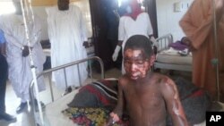 In this photo taken with a mobile phone, a man receives treatment at Konduga specialist hospital, following an attack by suspected Islamic extremists in Kawuri, Maiduguri, Nigeria, Tuesday, Jan. 28, 2014. At least 85 residents of the village were unable to escape the blast. 