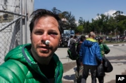 American Michael Churton, injured at Everest Base Camp, arrives at the airport in Kathmandu, Nepal, April 27, 2015.
