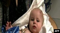 Operacioni në tru ndal spazmën foshnjore; Mbipesha dhe osteoporoza