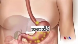 သတိထားဖွယ်ရာ စားချဉ့်ပြန်ရောဂါ