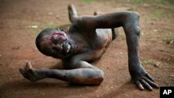 Kevin, a man accused of being a thief by civil servants at the Work Inspection office, lies in pain after being attacked by a man with a machete and sticks in plain view of others in Bangui, Central African Republic, April 18, 2014.