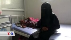 مردنی مندالان بەهۆی کەمخۆراکی