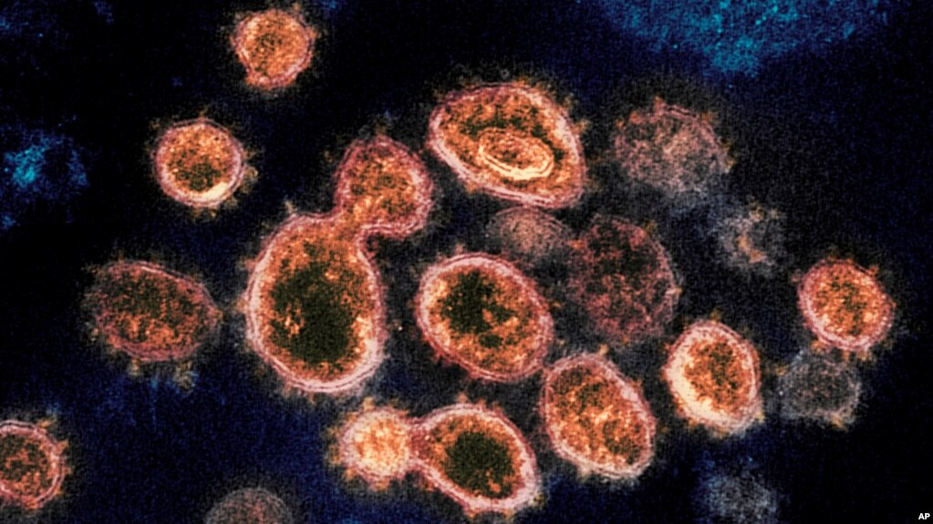 Hình ảnh chụp virus SARS-CoV-2 qua kính hiển vi electron