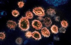 FILE - This 2020 electron microscope image provided by the National Institute of Allergy and Infectious Diseases - Rocky Mountain Laboratories shows particles of the virus that causes COVID-19 emerging from the surface of cells.