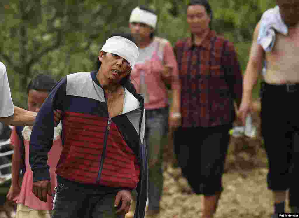 An injured woman walks with her relatives after an earthquake hit Longtoushan township, Ludian county, Yunnan province, Aug. 4, 2014.&nbsp;