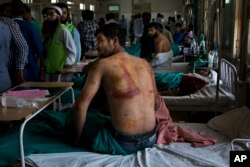 In this Aug. 18, 2016 file photo, Sameer Ahmed, a Kashmiri man allegedly beaten up by Indian soldiers at Khrew village, recovers at a local hospital in Srinagar, Indian controlled Kashmir.