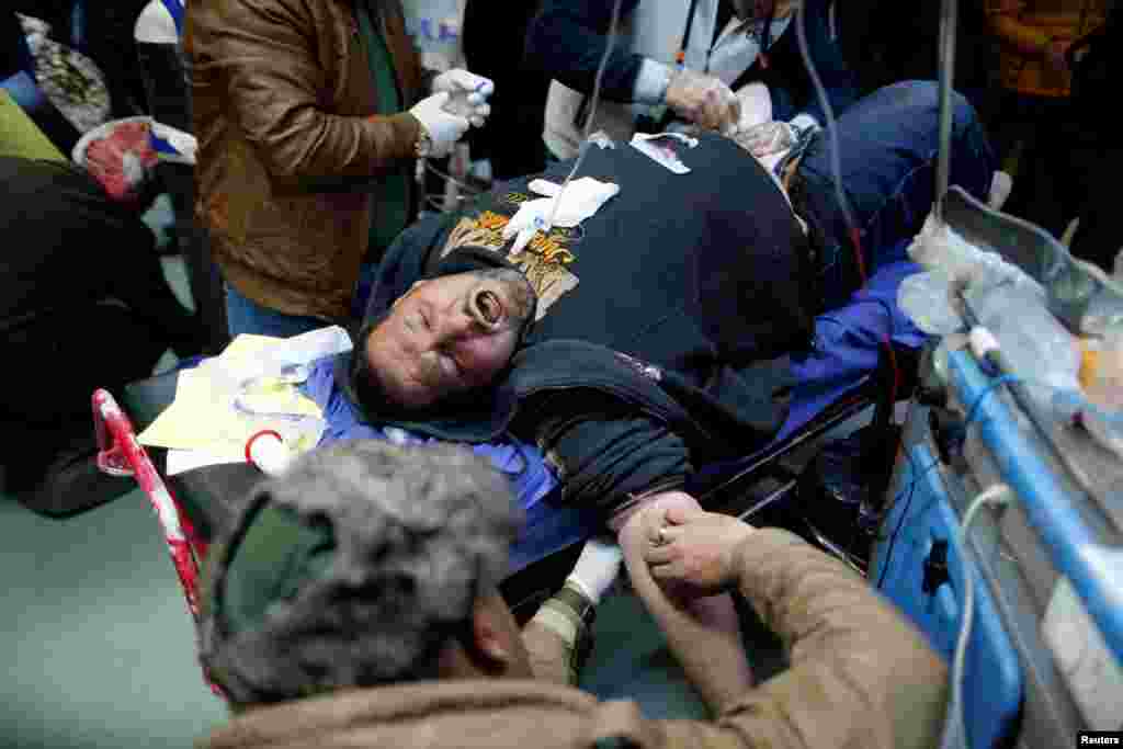 A man wounded in a bomb attack receives treatment at a hospital in the northern Iraqi city of Irbil.