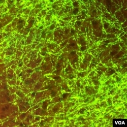Dense nerve connections in the mouse cortex. (Allen Institute for Brain Science)