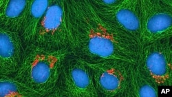 This undated image made available by the National Institutes of Health and National Center for Microscopy in Aug. 2013 shows cancerous cells, called HeLa cells.