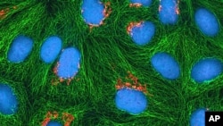 تصویری از سلول های سرطانی موسوم به سلول های هلا - قدیمی ترین سلول سرطانی کشف شده در بدن انسان که در پژوهش های علمی به کار می رود