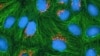 نقش یک پروتئین خاص در فلج کردن سلول های سرطانی