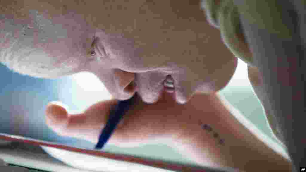 APTOPIX Albino Children Prosthetics