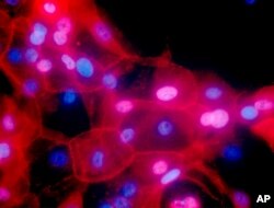 FILE - This undated fluorescence-colored microscope image made available by the National Institutes of Health in September 2016 shows a culture of human breast cancer cells.