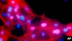 FILE - This undated colored microscope image made available by the National Institutes of Health in September 2016 shows a culture of human breast cancer cells. 